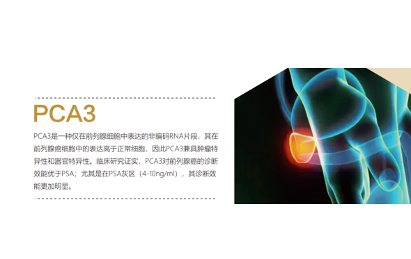 尿液PCA3